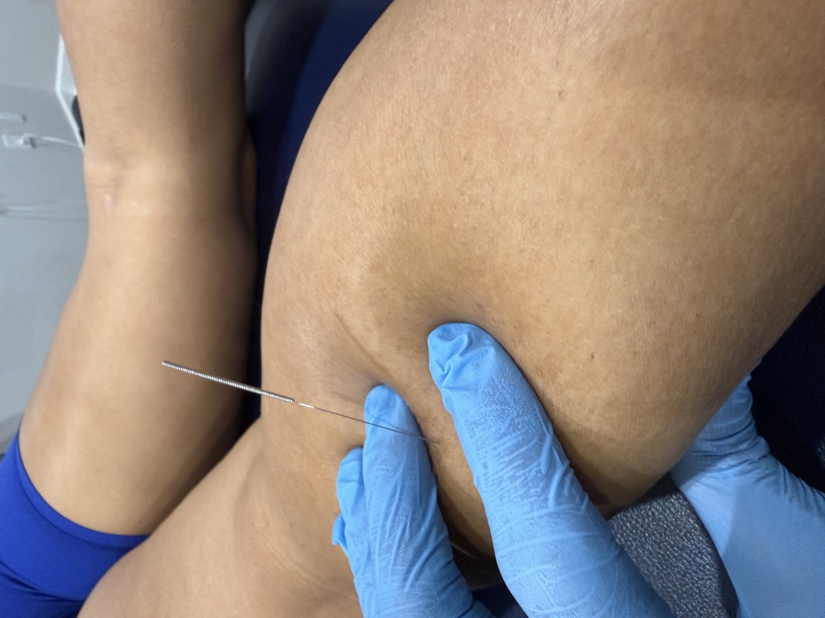 Orthopedic rehab at Elev8 Physical Therapy